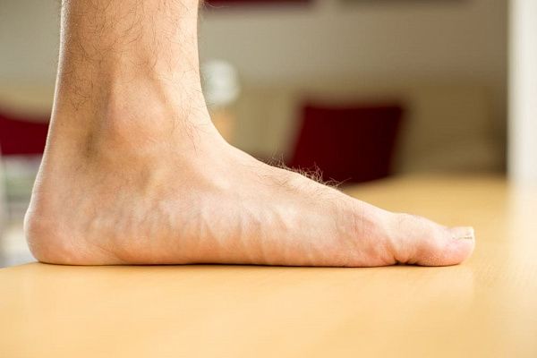 Как лечить плоскостопие